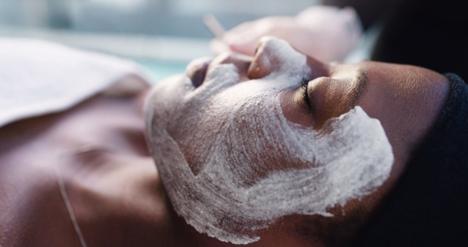 Chemical peel gallery 3