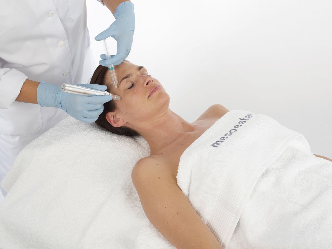 Practitioner administering microneedling facial treatment with medical device for skin rejuvenation at NewLife Aesthetics, Wimbledon & Raynes Park, London.