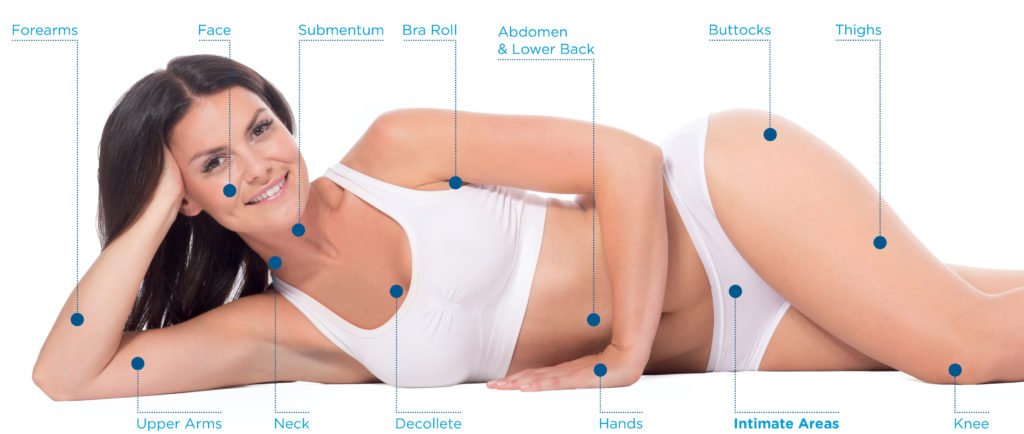 Exilis Ultra 360 body treatment areas diagram showing target zones for skin tightening