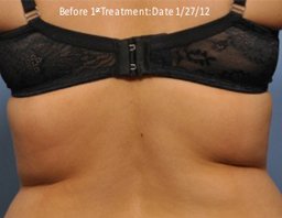 Exilis back before