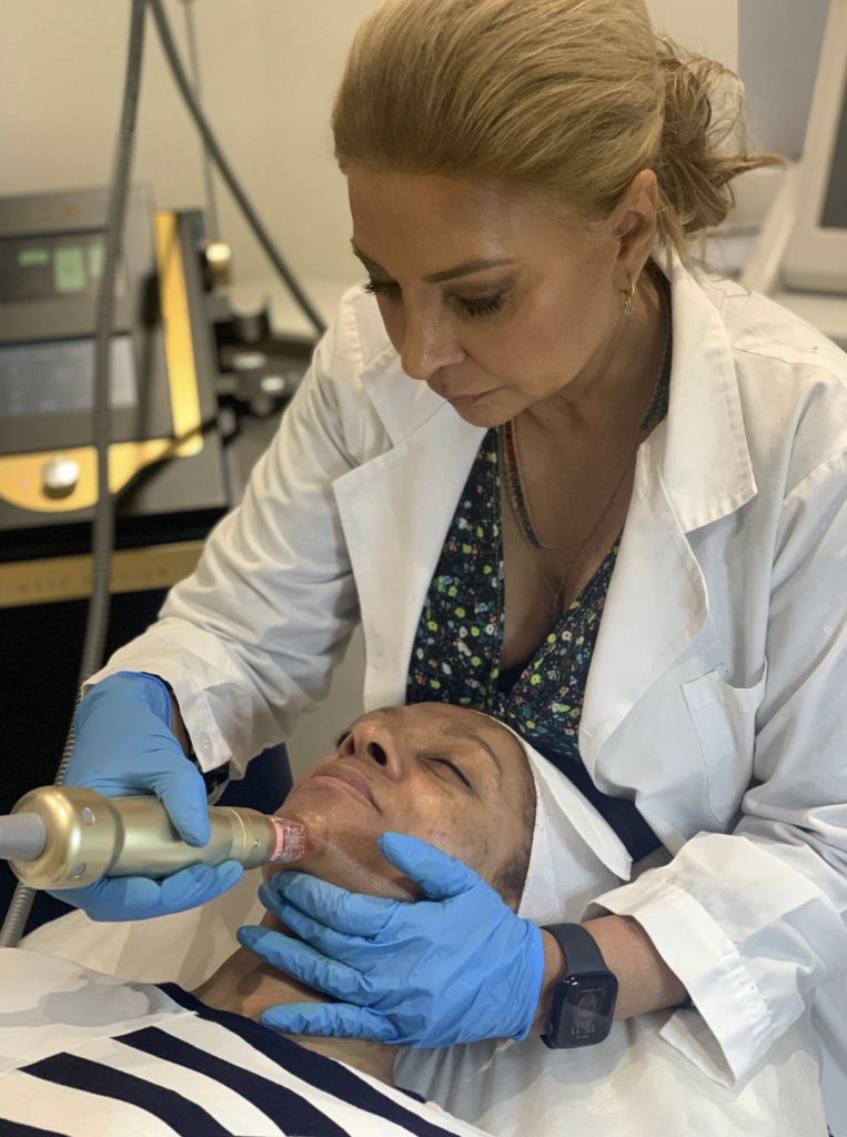 Practitioner Mo Ashraf performing RF microneedling facial treatment